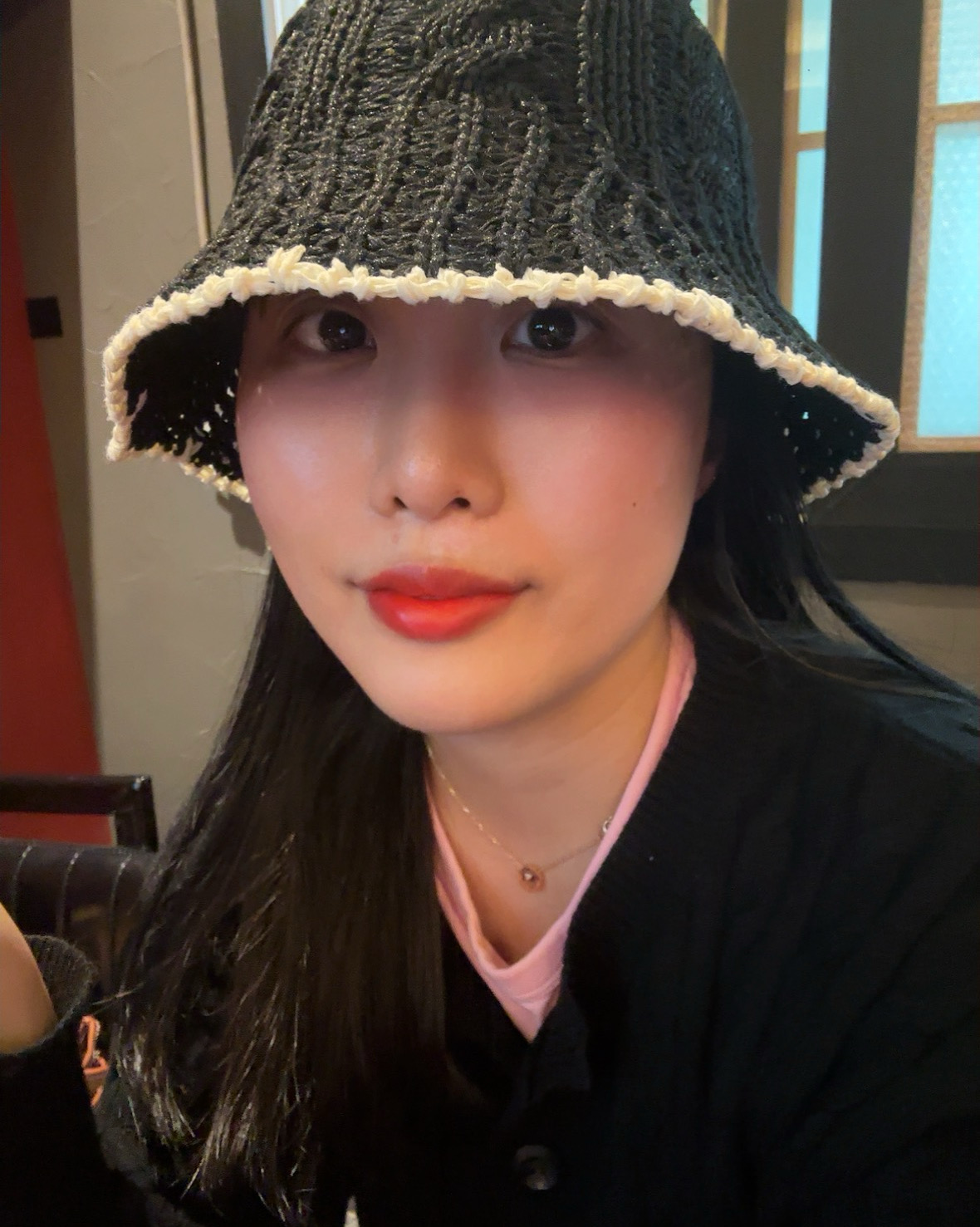 입꼬리필러랑 앞볼필러 받고 왔어요!