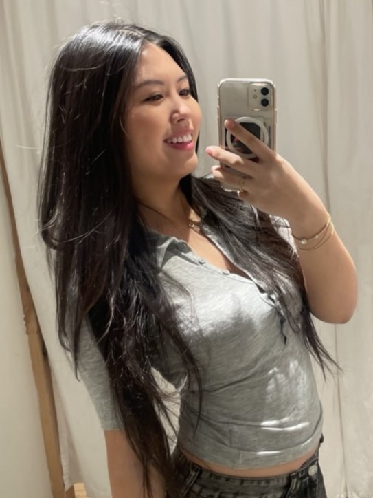 이마필러+쌍꺼풀&앞트임 수술 후기